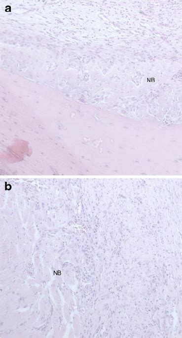 Control group at day 21. a Connective tissue rich in fibroblasts and... | Download Scientific ...