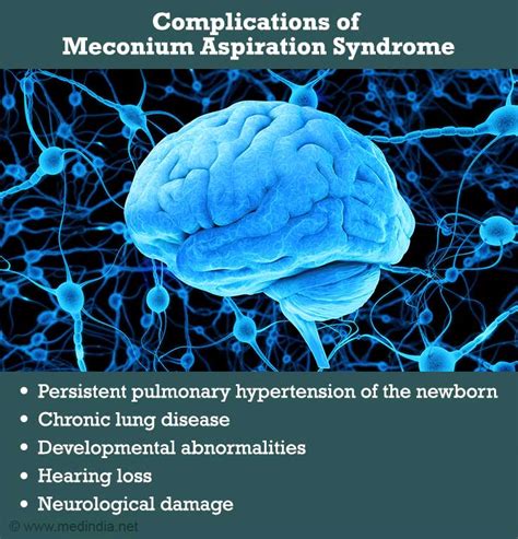 Meconium Aspiration Syndrome - Causes, Symptoms, Diagnosis ...