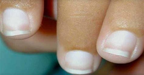 When You Need Isurance: The Best Beds Of Nails Are White Ideas