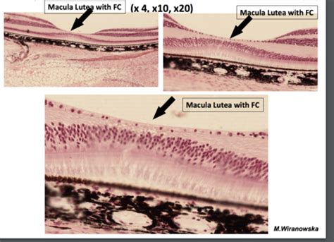 Macula Lutea Histology