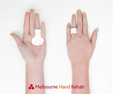 Why is my finger locked or clicking? Do I need surgery? - Melbourne Hand