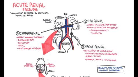 Acute Renal Failure - YouTube