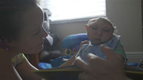 Baby Born With Partially Developed Brain Beats Odds to Meet Santa ...