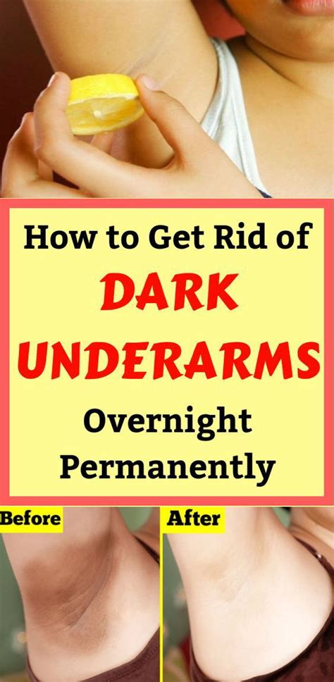 Effective Home Remedies to Lighten Dark Underarms