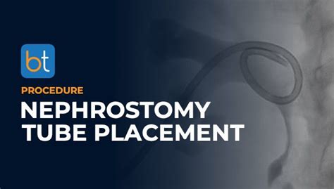 Nephrostomy Tube Placement Procedure | BackTable VI