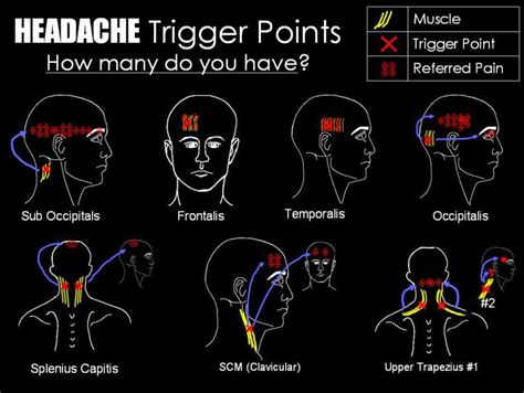 Headache: How To Relief Tension Headache