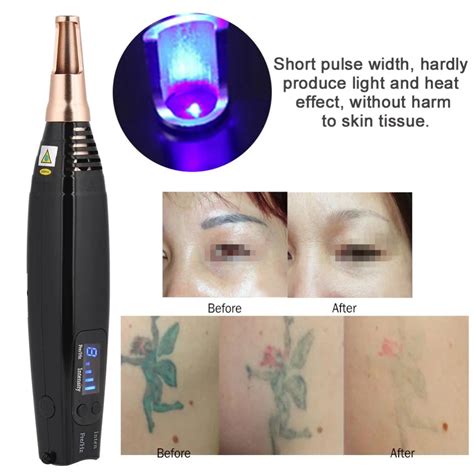 Aliexpress.com : Buy Scar Tattoo Removal Laser Pen Freckle Acne Mole ...