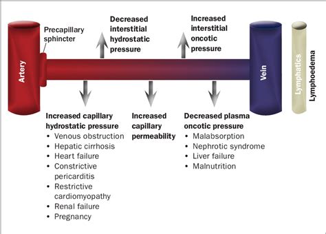 Figure 1 from A guide to peripheral oedema | Semantic Scholar