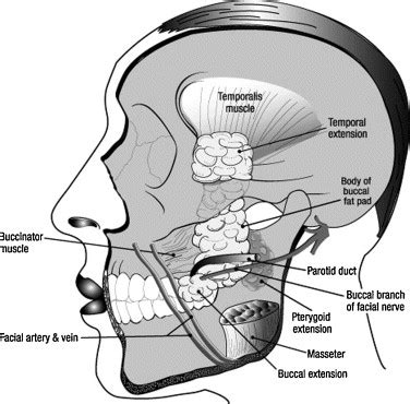 Pedicled buccal fat pad in the management of oroantral fistula: a ...