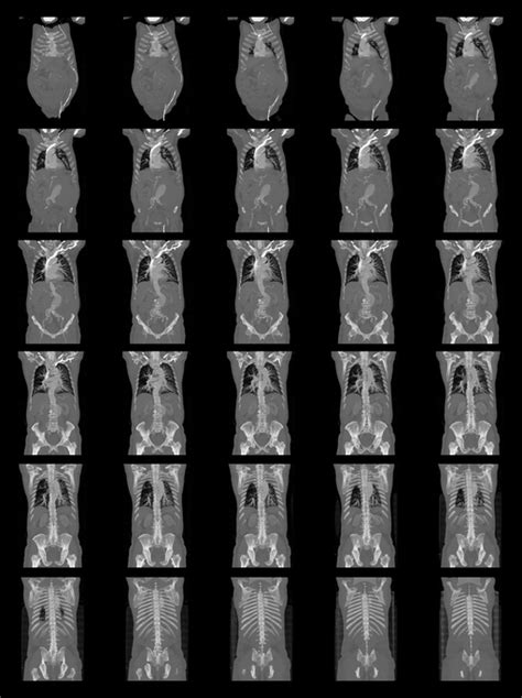 What is a Full Body CT scan? | Two Views