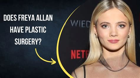 Freya Allan Plastic Surgery: Debunking the Rumors of Her Nose Job and Botox