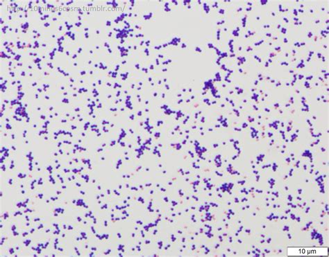 MICROCOSM | Zoonotic Streptococcus canis infection in...