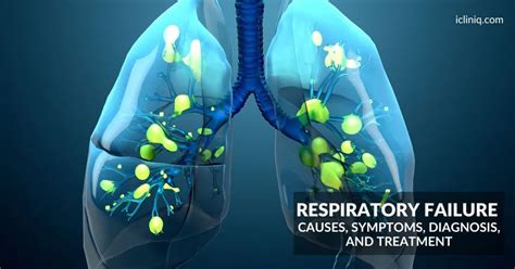 Respiratory Failure | Causes | Symptoms | Diagnosis | Treatment