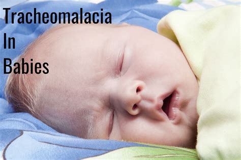 Tracheomalacia in Babies - Symptoms, Diagnosis and Treatment by Dr. Srikanta J T - Being The Parent