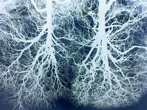 Two trees Lungs x-ray | intothewildone | Flickr