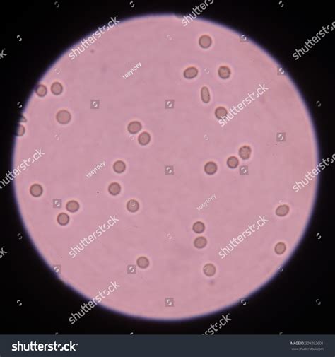 Red Blood Cells Urine Specimen Under Foto de stock 309292601 | Shutterstock