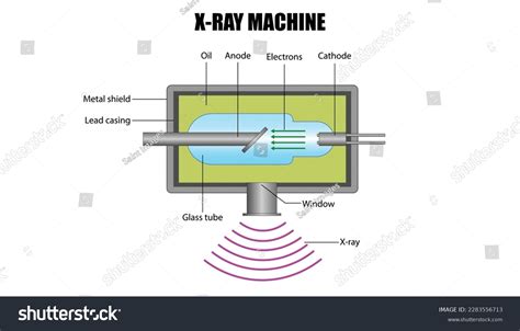 Diagram Xray Machine Stock Vector (Royalty Free) 2283556713 | Shutterstock