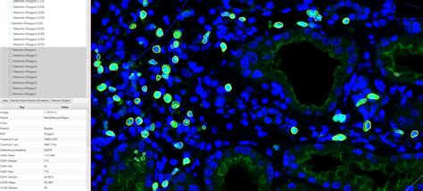 Create a cell object detecting cytoplasmic marker - Image Analysis ...