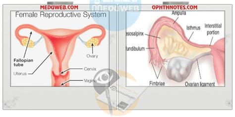 Fallopian tube (Uterine tube = Oviduct) Embryology – Anatomy ...