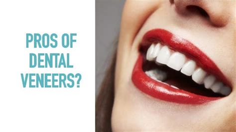 Pros and Cons of Dental Veneers