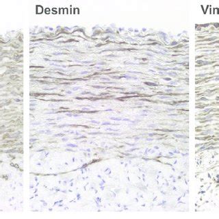 Smooth muscle cell markers for the detection of the arterial tunica ...