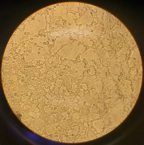 HEK Cell Splitting and Maintenance | &en Lab