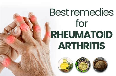 Arthritis Treatment: Discover the Best Home Remedies