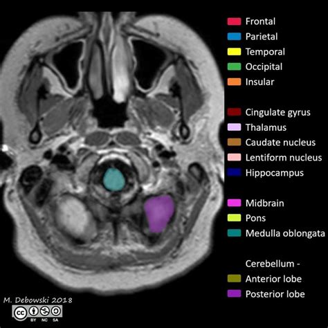 いいたしま Imaging Anatomy of the Head and Spaine E0Xbe-m13534347223 があり