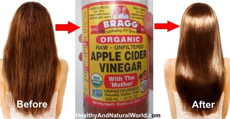 Why You Should Wash Your Hair With Apple Cider Vinegar