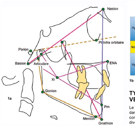 a et b-Détermination de la tendance typologique verticale (4).-FMA :... | Download Scientific ...