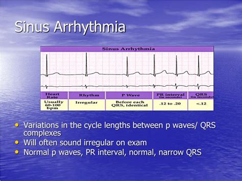 PPT - Cardiac Arrhythmias PowerPoint Presentation, free download - ID:3831276