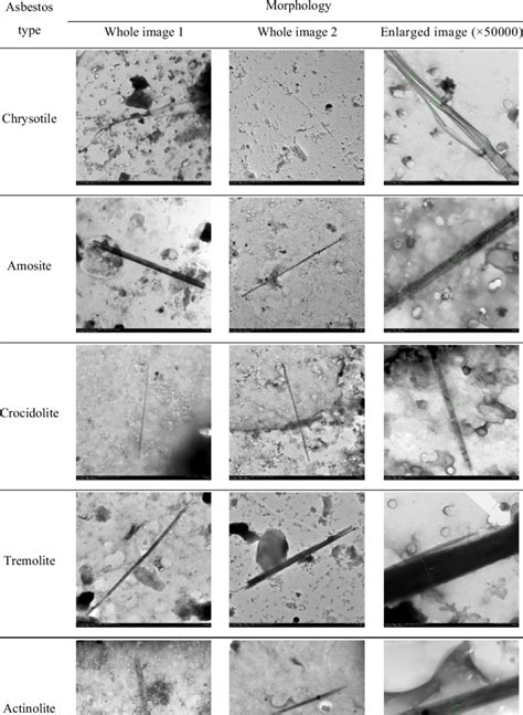 Comparison of morphology of detected asbestos fibers in lung tissue ...