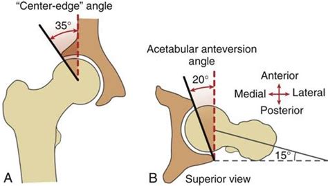 Hip | Musculoskeletal Key