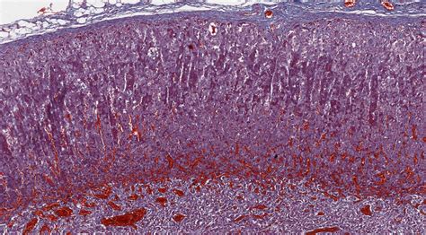 Adrenal Gland Histology Labeled