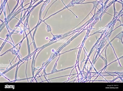 Photomicrograph of the mycelia, conidiophores, and conidia of the fungus Acremonium recifei ...