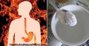 How to Use Baking Soda to Treat and Prevent Acid Reflux