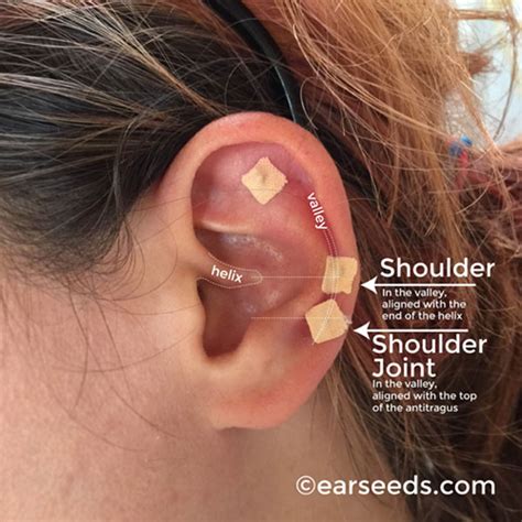 How I Got Rid of My Shoulder Pain Within 24 Hours - Ear Seeds Products