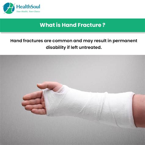 Hand Fracture: Symptoms and Treatment – Healthsoul