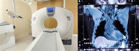 Medical X-Ray Imaging using Computed Tomography | Open Medscience