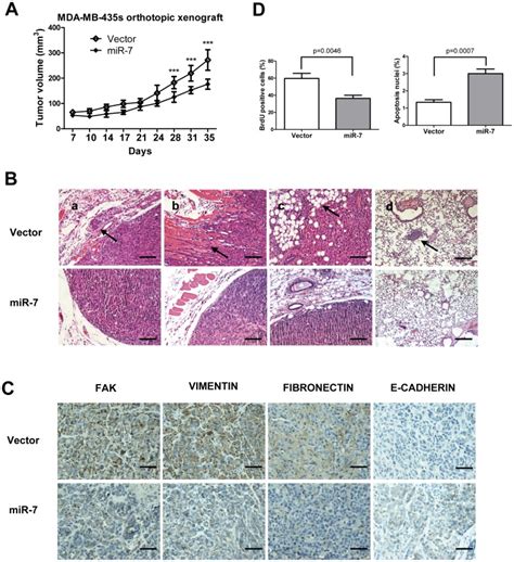 (A) Primary tumor growth upon orthotopic injection of 1.0×106... | Download Scientific Diagram