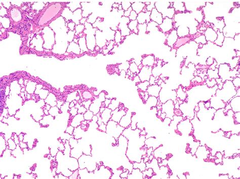 Terminal Bronchiole Histology