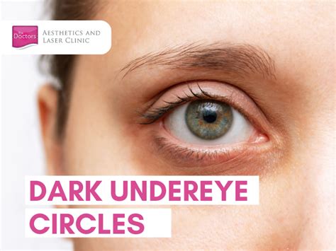 Dark Undereye Circles - Causes and Treatments