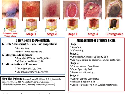 Stage 1 Pressure Ulcer Buttocks