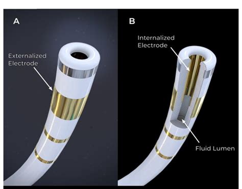 Field Medical Announces First-in-Human Trials for Groundbreaking FieldForce™ Ventricular Pulsed ...