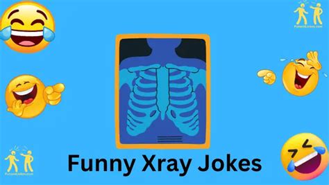 60+ Funny X-Ray Jokes: Laugh With These Radiology Humor Gems