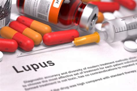 Saphnelo approved to treat systemic lupus erythematosus