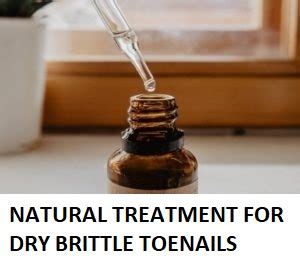 Natural Treatment For Dry Brittle Toenails - Homeopathic Remedy Finder