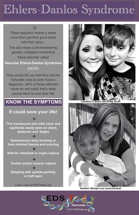 Pin by EDS Today ~ ADVOCATES on Ehlers-Danlos Education & Awareness | Elhers danlos syndrome ...