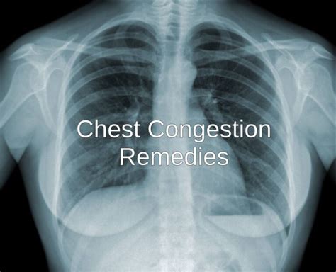 10 Home Remedies for Chest Congestion - Home Remedies App