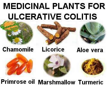 Medicinal plant remedies for ulcerative colitis – Botanical online